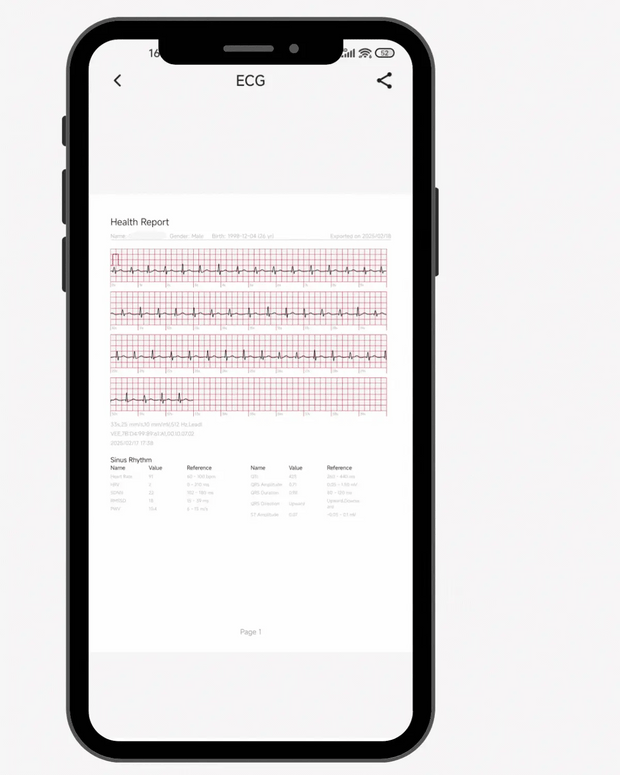Retrospective Analysis
