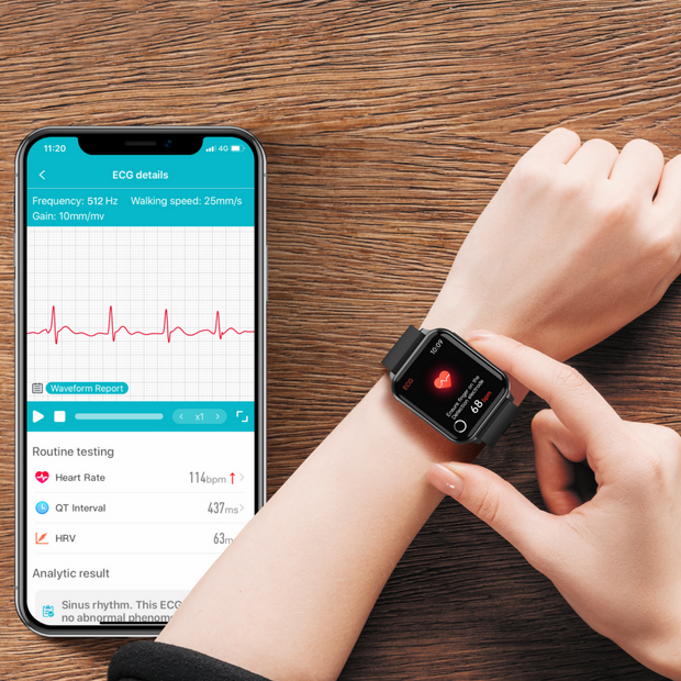 <strong>ECG Rhythm Check</strong>